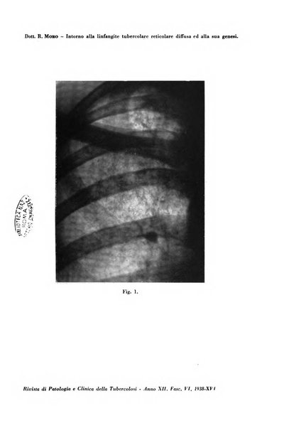 Rivista di patologia e clinica della tubercolosi organo ufficiale della Società italiana fascista di studi scientifici sulla tubercolosi