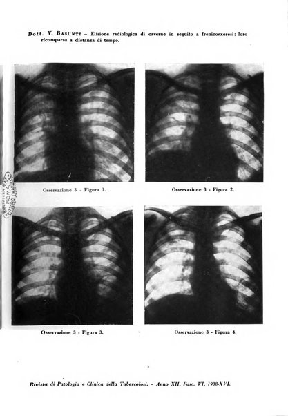 Rivista di patologia e clinica della tubercolosi organo ufficiale della Società italiana fascista di studi scientifici sulla tubercolosi