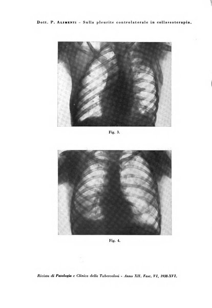 Rivista di patologia e clinica della tubercolosi organo ufficiale della Società italiana fascista di studi scientifici sulla tubercolosi