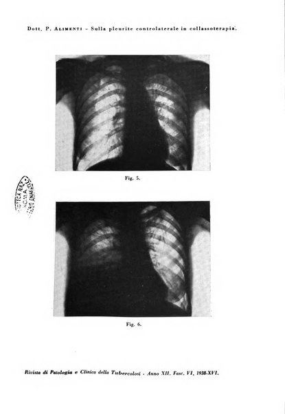 Rivista di patologia e clinica della tubercolosi organo ufficiale della Società italiana fascista di studi scientifici sulla tubercolosi