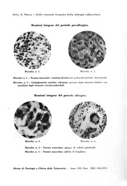 Rivista di patologia e clinica della tubercolosi organo ufficiale della Società italiana fascista di studi scientifici sulla tubercolosi