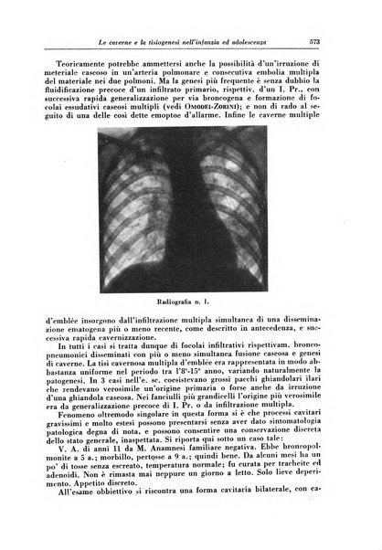 Rivista di patologia e clinica della tubercolosi organo ufficiale della Società italiana fascista di studi scientifici sulla tubercolosi