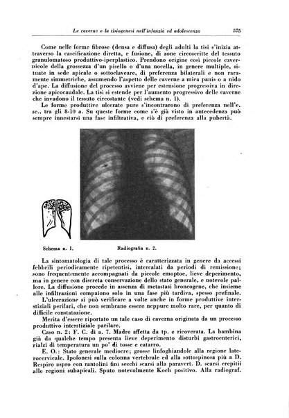 Rivista di patologia e clinica della tubercolosi organo ufficiale della Società italiana fascista di studi scientifici sulla tubercolosi