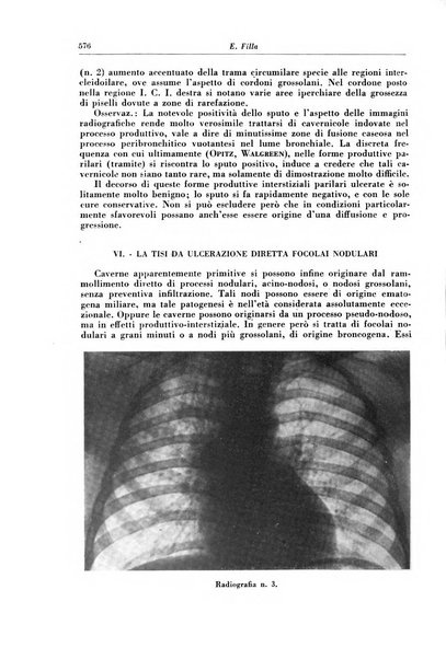 Rivista di patologia e clinica della tubercolosi organo ufficiale della Società italiana fascista di studi scientifici sulla tubercolosi