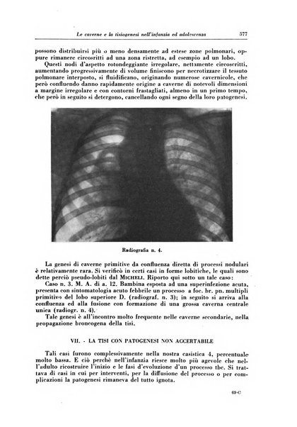 Rivista di patologia e clinica della tubercolosi organo ufficiale della Società italiana fascista di studi scientifici sulla tubercolosi