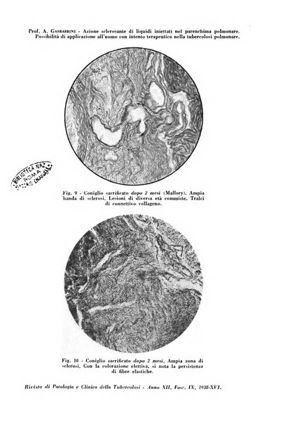 Rivista di patologia e clinica della tubercolosi organo ufficiale della Società italiana fascista di studi scientifici sulla tubercolosi