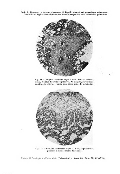 Rivista di patologia e clinica della tubercolosi organo ufficiale della Società italiana fascista di studi scientifici sulla tubercolosi