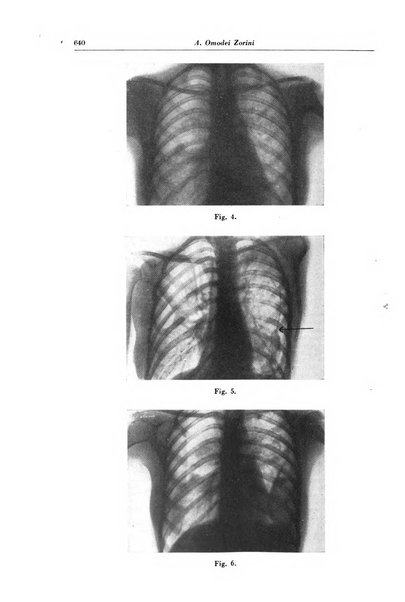 Rivista di patologia e clinica della tubercolosi organo ufficiale della Società italiana fascista di studi scientifici sulla tubercolosi