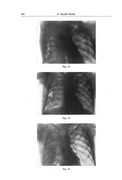 Rivista di patologia e clinica della tubercolosi organo ufficiale della Società italiana fascista di studi scientifici sulla tubercolosi