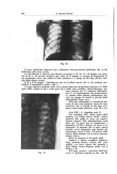 Rivista di patologia e clinica della tubercolosi organo ufficiale della Società italiana fascista di studi scientifici sulla tubercolosi