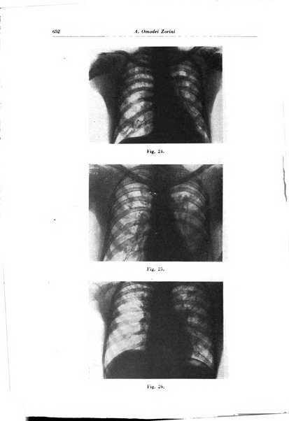 Rivista di patologia e clinica della tubercolosi organo ufficiale della Società italiana fascista di studi scientifici sulla tubercolosi