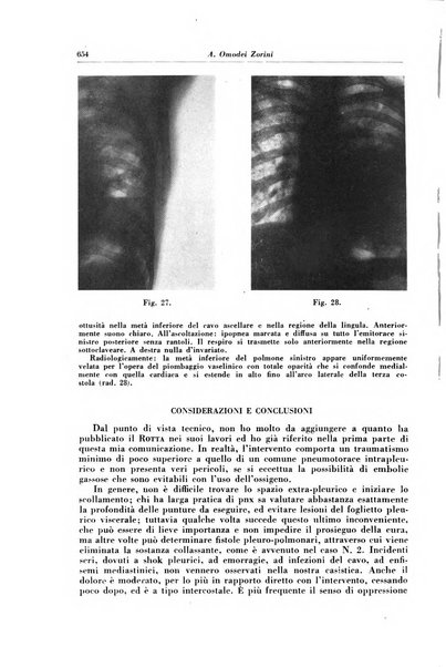 Rivista di patologia e clinica della tubercolosi organo ufficiale della Società italiana fascista di studi scientifici sulla tubercolosi