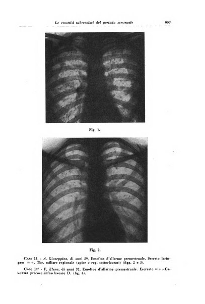 Rivista di patologia e clinica della tubercolosi organo ufficiale della Società italiana fascista di studi scientifici sulla tubercolosi