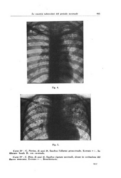 Rivista di patologia e clinica della tubercolosi organo ufficiale della Società italiana fascista di studi scientifici sulla tubercolosi