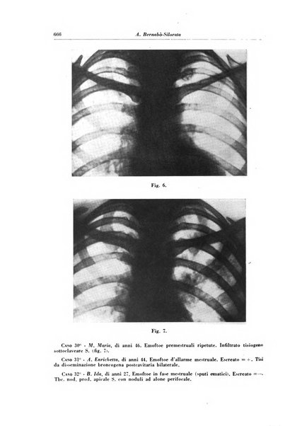 Rivista di patologia e clinica della tubercolosi organo ufficiale della Società italiana fascista di studi scientifici sulla tubercolosi