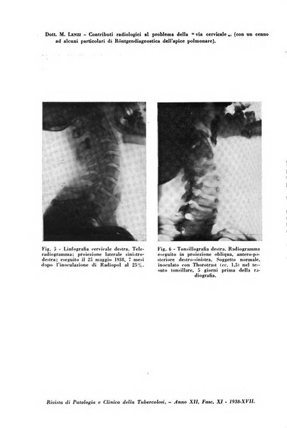 Rivista di patologia e clinica della tubercolosi organo ufficiale della Società italiana fascista di studi scientifici sulla tubercolosi