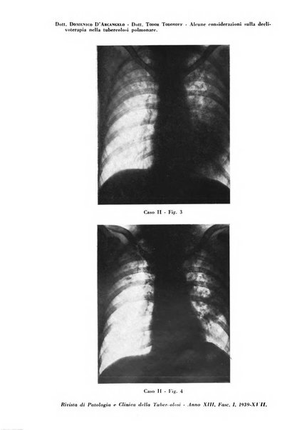 Rivista di patologia e clinica della tubercolosi organo ufficiale della Società italiana fascista di studi scientifici sulla tubercolosi