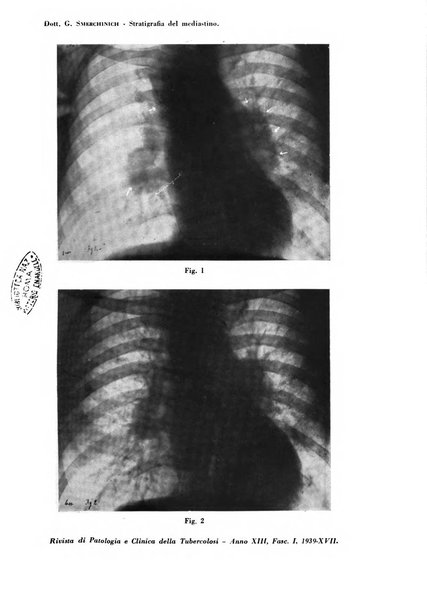 Rivista di patologia e clinica della tubercolosi organo ufficiale della Società italiana fascista di studi scientifici sulla tubercolosi