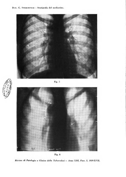 Rivista di patologia e clinica della tubercolosi organo ufficiale della Società italiana fascista di studi scientifici sulla tubercolosi