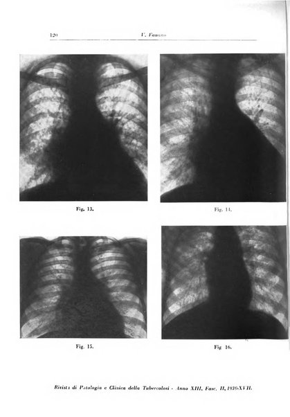 Rivista di patologia e clinica della tubercolosi organo ufficiale della Società italiana fascista di studi scientifici sulla tubercolosi