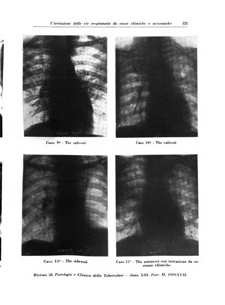 Rivista di patologia e clinica della tubercolosi organo ufficiale della Società italiana fascista di studi scientifici sulla tubercolosi