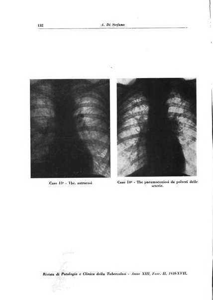 Rivista di patologia e clinica della tubercolosi organo ufficiale della Società italiana fascista di studi scientifici sulla tubercolosi