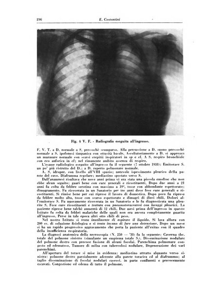 Rivista di patologia e clinica della tubercolosi organo ufficiale della Società italiana fascista di studi scientifici sulla tubercolosi