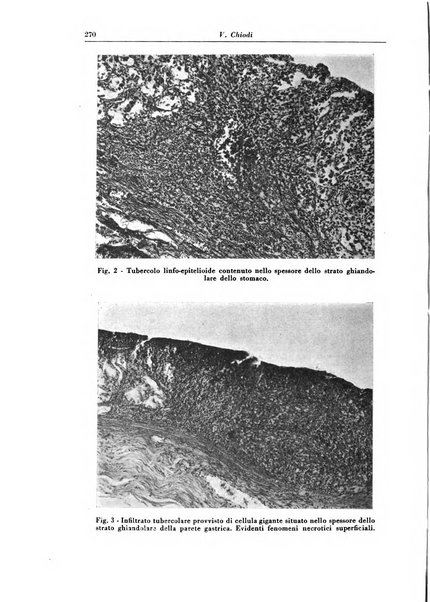 Rivista di patologia e clinica della tubercolosi organo ufficiale della Società italiana fascista di studi scientifici sulla tubercolosi