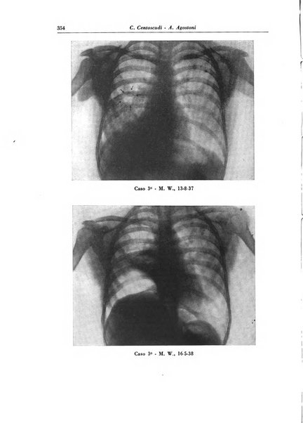 Rivista di patologia e clinica della tubercolosi organo ufficiale della Società italiana fascista di studi scientifici sulla tubercolosi