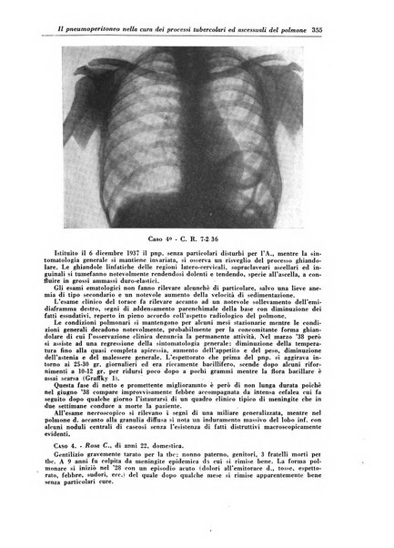 Rivista di patologia e clinica della tubercolosi organo ufficiale della Società italiana fascista di studi scientifici sulla tubercolosi