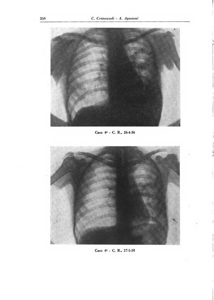 Rivista di patologia e clinica della tubercolosi organo ufficiale della Società italiana fascista di studi scientifici sulla tubercolosi