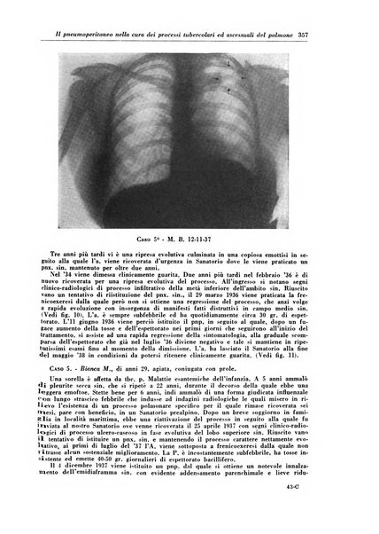 Rivista di patologia e clinica della tubercolosi organo ufficiale della Società italiana fascista di studi scientifici sulla tubercolosi