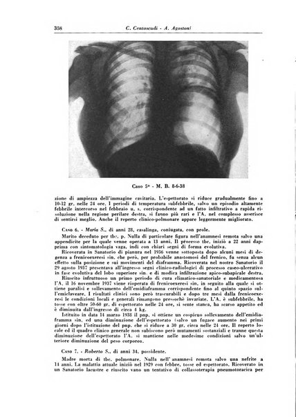 Rivista di patologia e clinica della tubercolosi organo ufficiale della Società italiana fascista di studi scientifici sulla tubercolosi