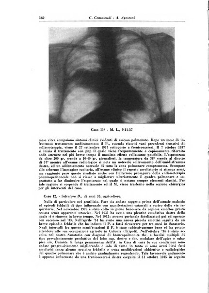 Rivista di patologia e clinica della tubercolosi organo ufficiale della Società italiana fascista di studi scientifici sulla tubercolosi