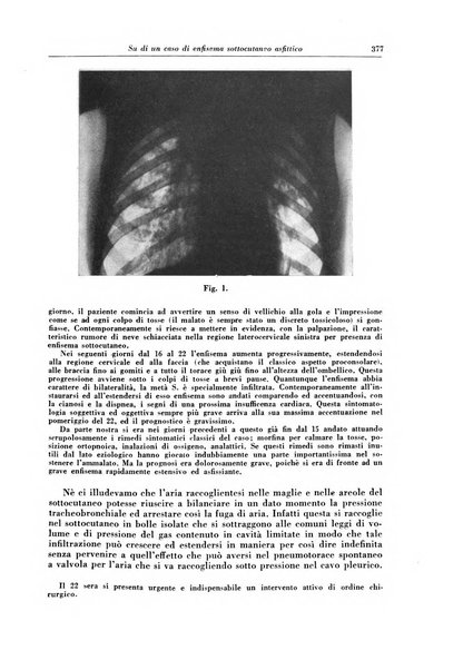 Rivista di patologia e clinica della tubercolosi organo ufficiale della Società italiana fascista di studi scientifici sulla tubercolosi