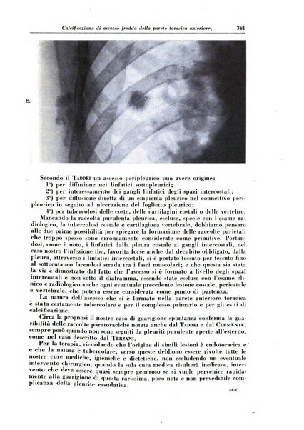 Rivista di patologia e clinica della tubercolosi organo ufficiale della Società italiana fascista di studi scientifici sulla tubercolosi