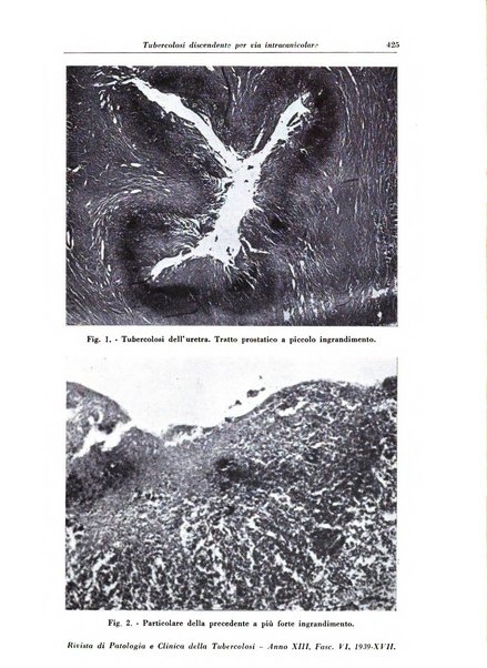 Rivista di patologia e clinica della tubercolosi organo ufficiale della Società italiana fascista di studi scientifici sulla tubercolosi