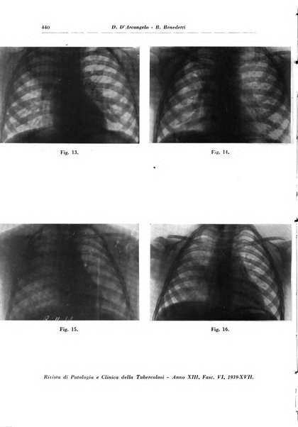 Rivista di patologia e clinica della tubercolosi organo ufficiale della Società italiana fascista di studi scientifici sulla tubercolosi