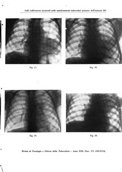 Rivista di patologia e clinica della tubercolosi organo ufficiale della Società italiana fascista di studi scientifici sulla tubercolosi