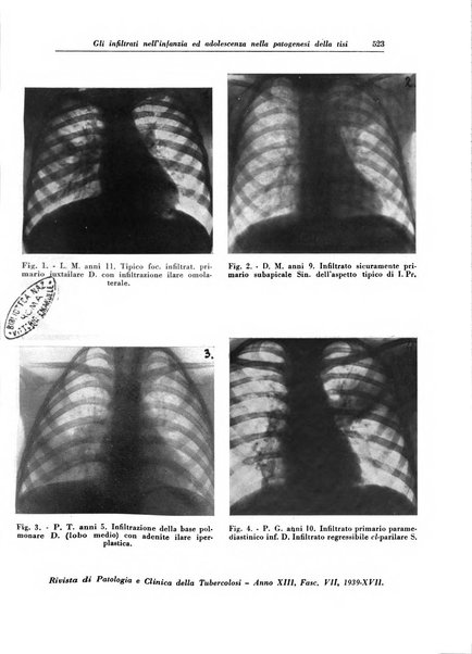 Rivista di patologia e clinica della tubercolosi organo ufficiale della Società italiana fascista di studi scientifici sulla tubercolosi