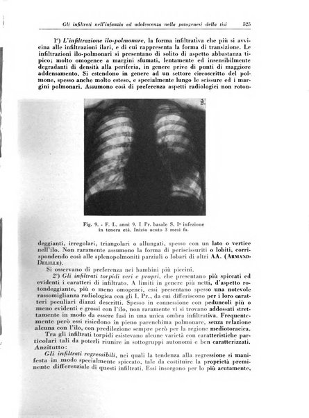 Rivista di patologia e clinica della tubercolosi organo ufficiale della Società italiana fascista di studi scientifici sulla tubercolosi