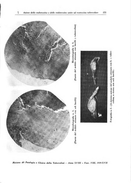 Rivista di patologia e clinica della tubercolosi organo ufficiale della Società italiana fascista di studi scientifici sulla tubercolosi