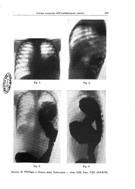 Rivista di patologia e clinica della tubercolosi organo ufficiale della Società italiana fascista di studi scientifici sulla tubercolosi