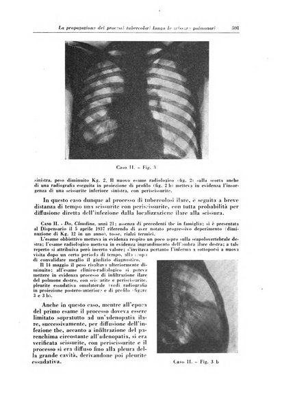 Rivista di patologia e clinica della tubercolosi organo ufficiale della Società italiana fascista di studi scientifici sulla tubercolosi