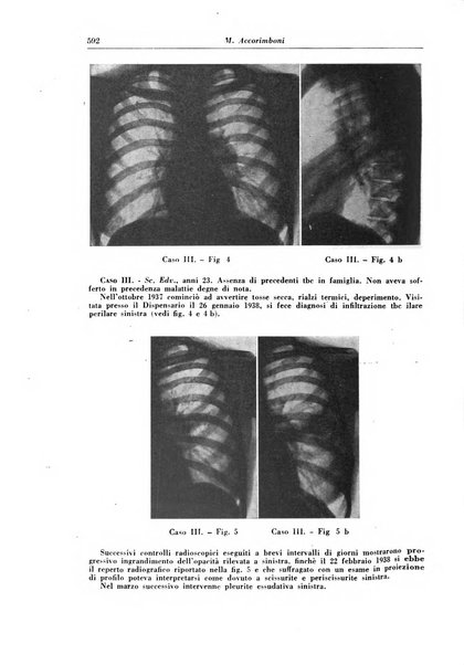 Rivista di patologia e clinica della tubercolosi organo ufficiale della Società italiana fascista di studi scientifici sulla tubercolosi