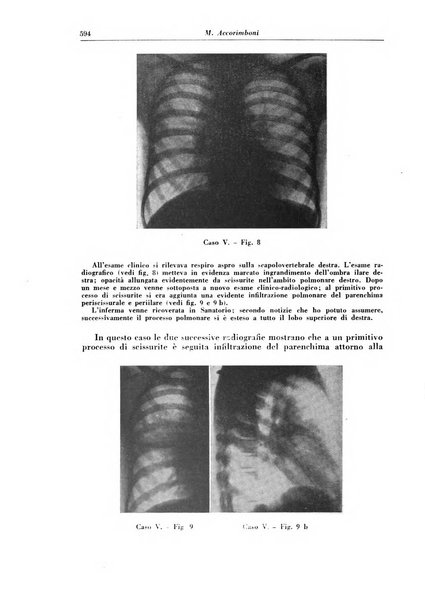 Rivista di patologia e clinica della tubercolosi organo ufficiale della Società italiana fascista di studi scientifici sulla tubercolosi