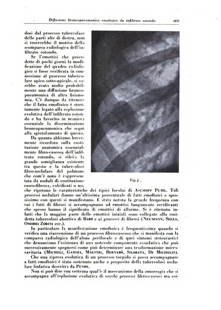 Rivista di patologia e clinica della tubercolosi organo ufficiale della Società italiana fascista di studi scientifici sulla tubercolosi