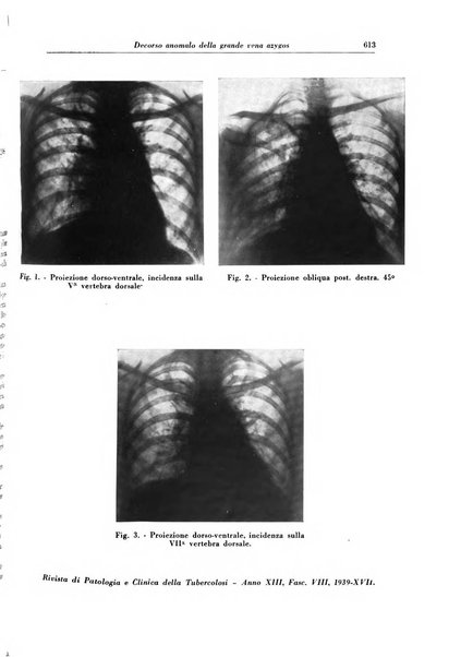 Rivista di patologia e clinica della tubercolosi organo ufficiale della Società italiana fascista di studi scientifici sulla tubercolosi