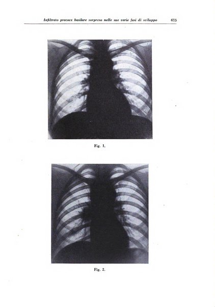 Rivista di patologia e clinica della tubercolosi organo ufficiale della Società italiana fascista di studi scientifici sulla tubercolosi