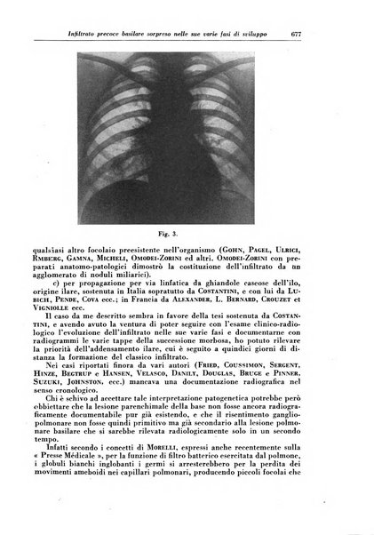 Rivista di patologia e clinica della tubercolosi organo ufficiale della Società italiana fascista di studi scientifici sulla tubercolosi